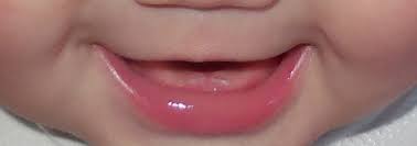 Схема прорезывания молочных зубов у детей: последовательность, сроки, картинка - фотография